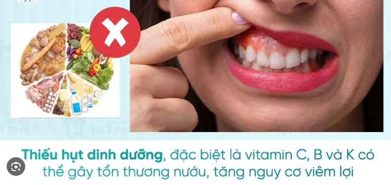 chay-mau-chan-rang-do-dau-va-cach-khac-phuc-87
