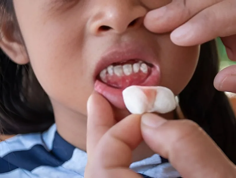 Một số thuốc chống đông có thể làm tình trạng chảy máu nướu khó cầm hơn.